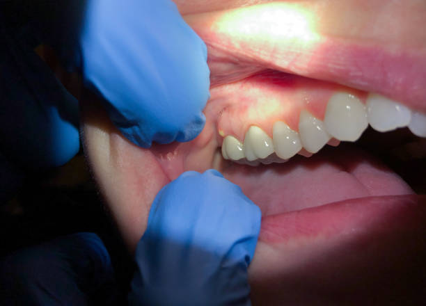 Best Mobile Emergency Dentist in Montz, LA